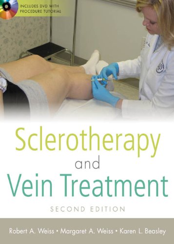 vein surgery
