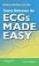 Pocket Reference for ECGs Made Easy
