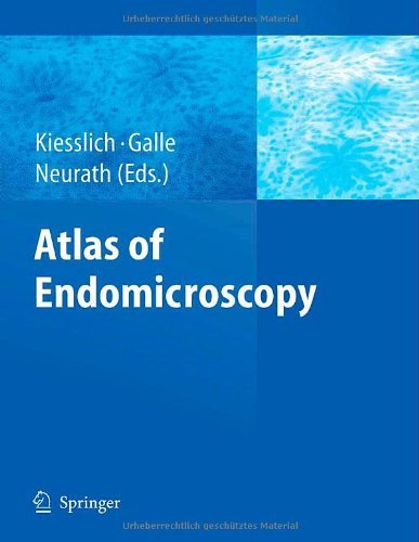 Atlas of Endomicroscopy