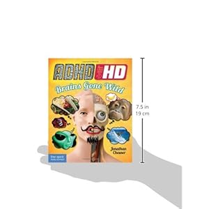ADHD in HD: Brains Gone Wild