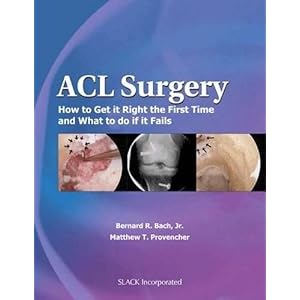 Click here to buy ACL Surgery: How To Get It Right the First Time and What To Do if it Fails by Bernard Bach Jr. MD and Matthew Provencher MD.