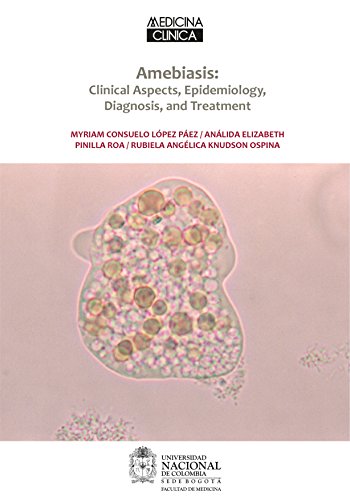 Amebiasis: Clinical Aspects, Epidemiology, Diagnosis, and Treatmen