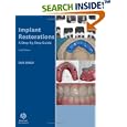 Implant Restorations: A Step-by-Step Guide by Carl Drago