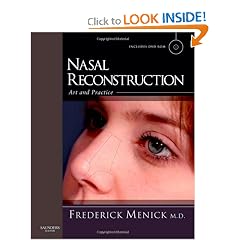 Nasal Reconstruction: Art and Practice by Frederick J. Menick MD