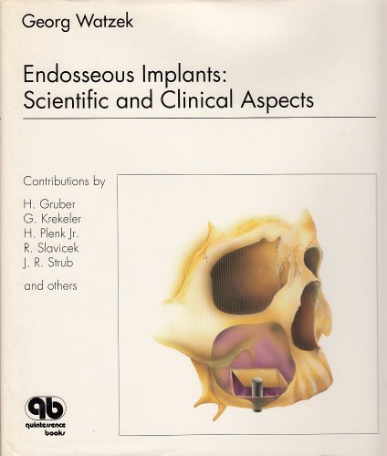 endosseous implants scientific and clinical aspects