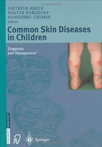 Common Skin Diseases in Children: Diagnosis and Management