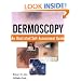 Dermoscopy: An Illustrated Self-Assessment Guide