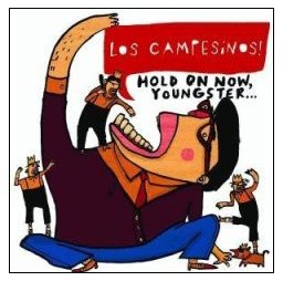 Los Campesinos - Hold on Now Youngster: Limited Edition - Zortam Music