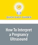 How To Interpret a Pregnancy Ultrasound