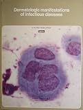 Dermatologic manifestations of infectious diseases (A Scope publication)