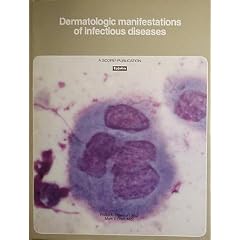Dermatologic manifestations of infectious diseases (A Scope publication) by Phillip K.  Peterson and Mark V. Dahl