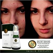 植物ハーブエキス贅沢配合、ニキビケア（アクネケア）極上美容液『リヒトレーネ　アクナアングリフ』