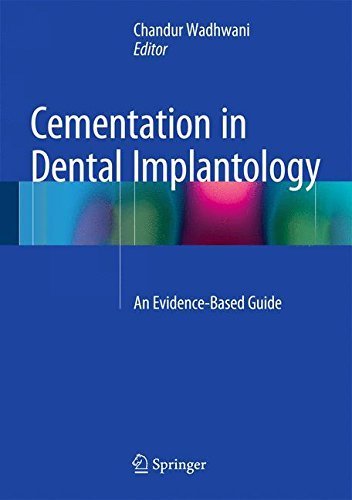 Cementation in Dental Implantology: An Evidence-Based Guide (2014-12-04)