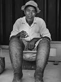 Samoan Victim of Elephantiasis Photographic Poster Print by Carl Mydans, 18x24