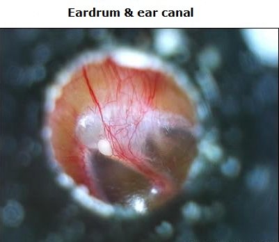 Image #9 of Short 2.0MP Handheld