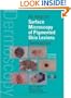 An Atlas of Surface Microscopy of Pigmented Skin Lesions: Dermoscopy,  Second Edition