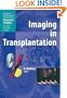 Imaging in Transplantation (Medical Radiology / Diagnostic Imaging)
