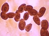 Tetrahymena Thermophila X125 Photographic Poster Print, 16x12
