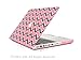 TOP CASE - Chevron Series Matte Hard Case Compatible Old Generation MacBook Pro 13
