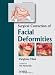 Surgical Correction of Facial Deformities
