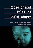 Radiological atlas of child abuse