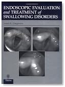 Endoscopic Evaluation and Treatment of Swallowing Disorders