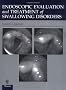 Endoscopic Evaluation and Treatment of Swallowing Disorders
