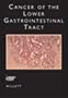 Cancer of the Lower Gastrointestinal Tract (Atlas of Clinical Oncology)