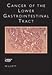 Cancer of the Lower Gastrointestinal Tract (Atlas of Clinical Oncology)