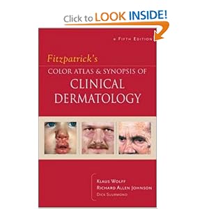 Click here to buy Fitzpatrick's Color Atlas and Synopsis of Clinical Dermatology by Klaus Wolff, Richard. Johnson, and Richard Suurmond.