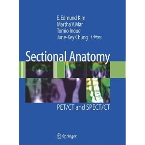 41zLvFMeqAL. SL500 AA300  Sectional Anatomy: PET/CT and SPECT/CT