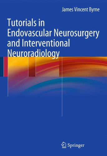 Tutorials in Endovascular Neurosurgery and Interventional Neuroradiology, by James Vincent Byrne