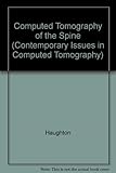 Computed tomography of the spine