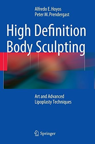 High Definition Body Sculpting: Art and Advanced Lipoplasty Techniques by Alfredo Hoyos (2014-07-30)