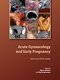 Acute gynaecology and early pregnancy