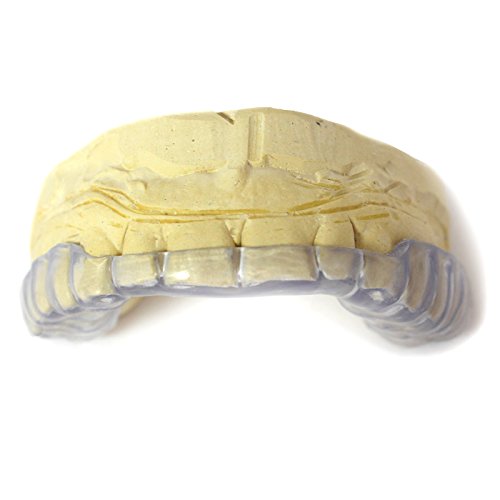 J S Dental Lab Professional Grade Custom Made Hard Night Guard UPPER for Moderate Teeth Grinding