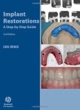 Implant Restorations: A Step-by-Step Guide