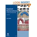 Implant Restorations: A Step-by-Step Guide