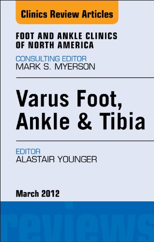 Varus Foot, Ankle, and Tibia,  An Issue of Foot and Ankle Clinics (The Clinics: Orthopedics)