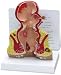 Rectum Model with Pathologies