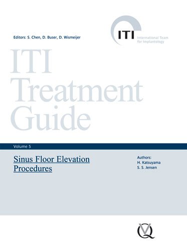 sinus floor elevation procedures iti treatment guide volume 5 iti treatment guides
