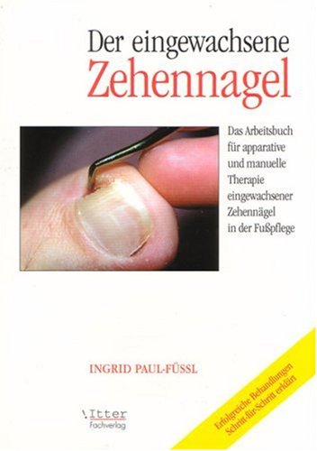 Der eingewachsene Zehennagel "
