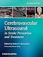 Cerebrovascular Ultrasound in Stroke Prevention and Treatment