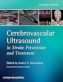 Cerebrovascular Ultrasound in Stroke Prevention and Treatment