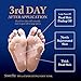 Wonder Foot Exfoliating Foot Mask - with Lactic Acid & Milk (PH3.6) – Guaranteed to Rejuvenate Your foot In 7 Days - Sold Exclusively on Amazon