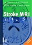 Stroke MRI
