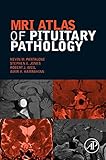 MRI atlas of pituitary pathology