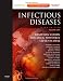 Infectious Diseases: Expert Consult: Online and Print - 2 Volume Set, 3e (Infectious Diseases (Armstrong/ Mosby))