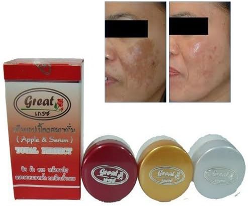 3 Sets X 3 in 1 Mei - Yong Super Extra Whitening Cream Red Apple Mixed Q10 Serum Face Lift Natural Algae 100% Nature.(3items in Set)(whitening + Aging + Reduce Dark Spot + Melasma + Acne) 1 Set Have 3 Items.