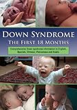 Down Syndrome: The First 18 Months